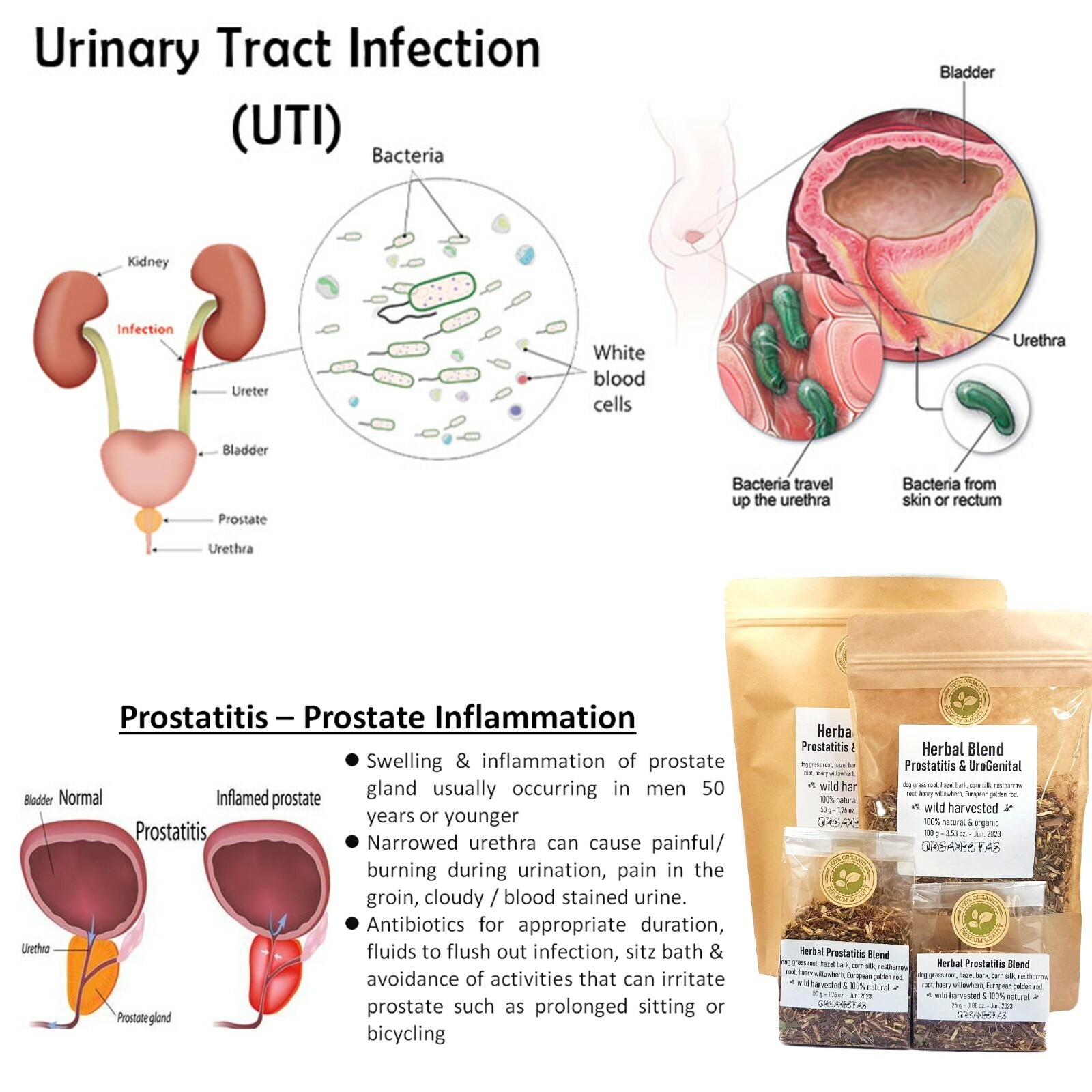 Urinary System & Prostate Herbal Blend Tea, 6 Herbs for Urinary Tract Problems