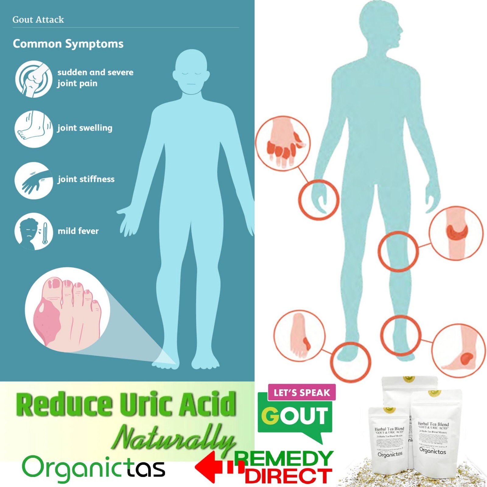GOUT TEA Patented Organic 24 Natural Herbs Normal Uric Acid Formula Gout Relief