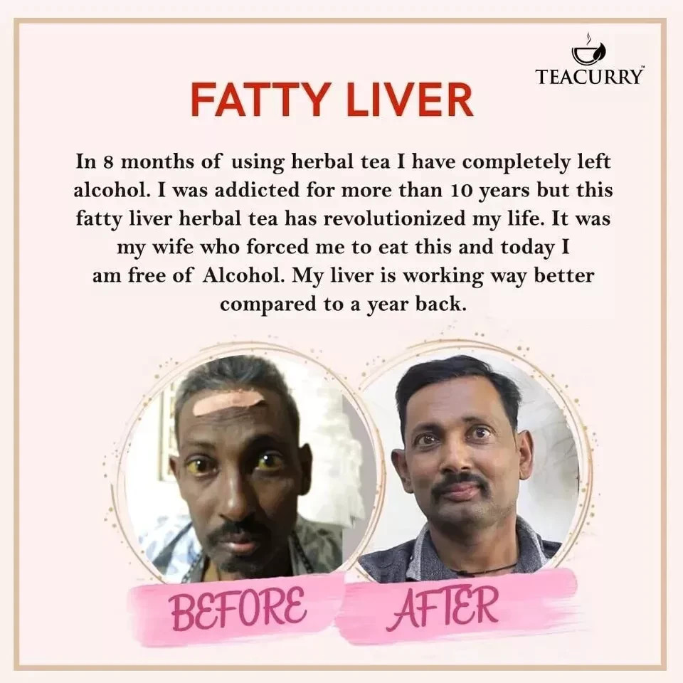 TEACURRY Fatty Liver Tea 30 Tea Bags Free Shipping World Wide