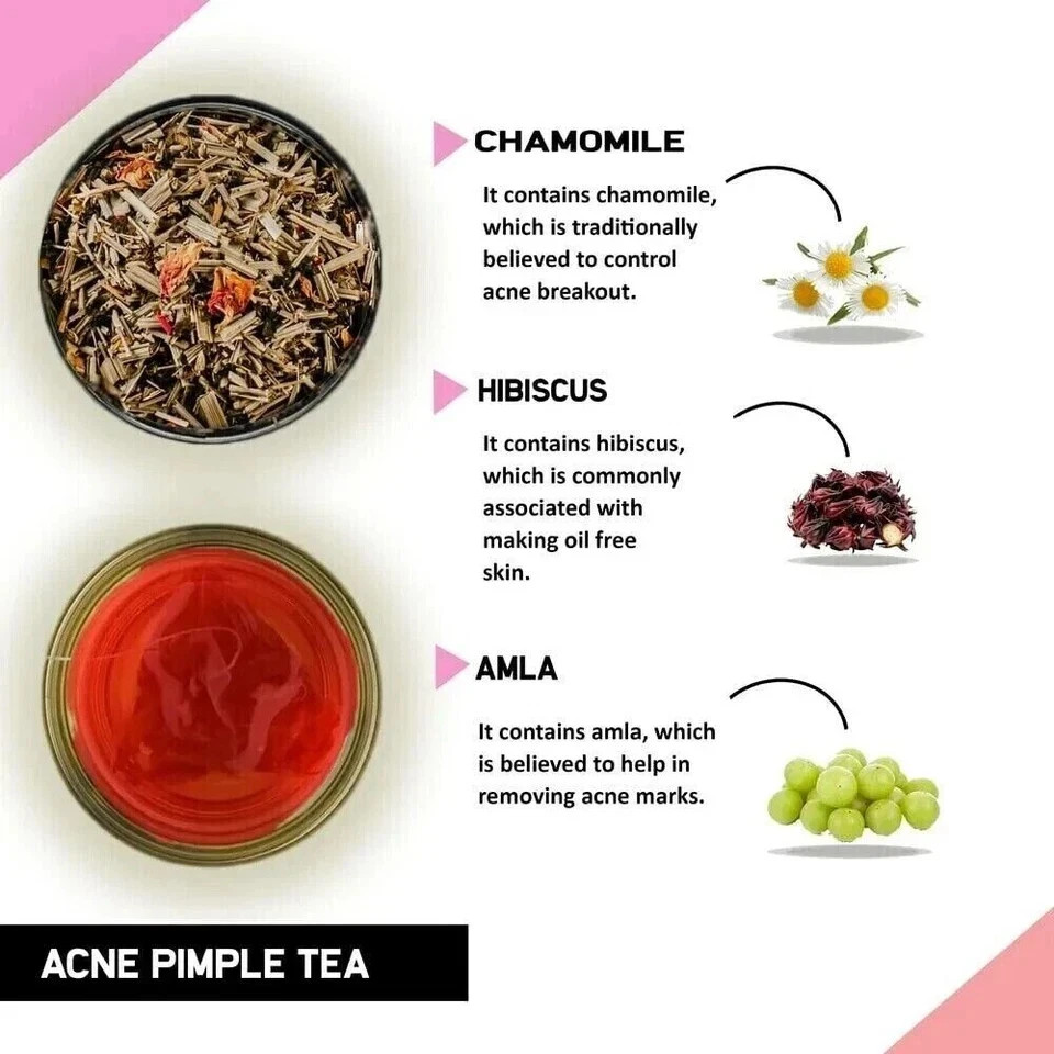 TEACURRY Green Tea Fresh Acne Tea – 50 Gram Free Shipping World Wide